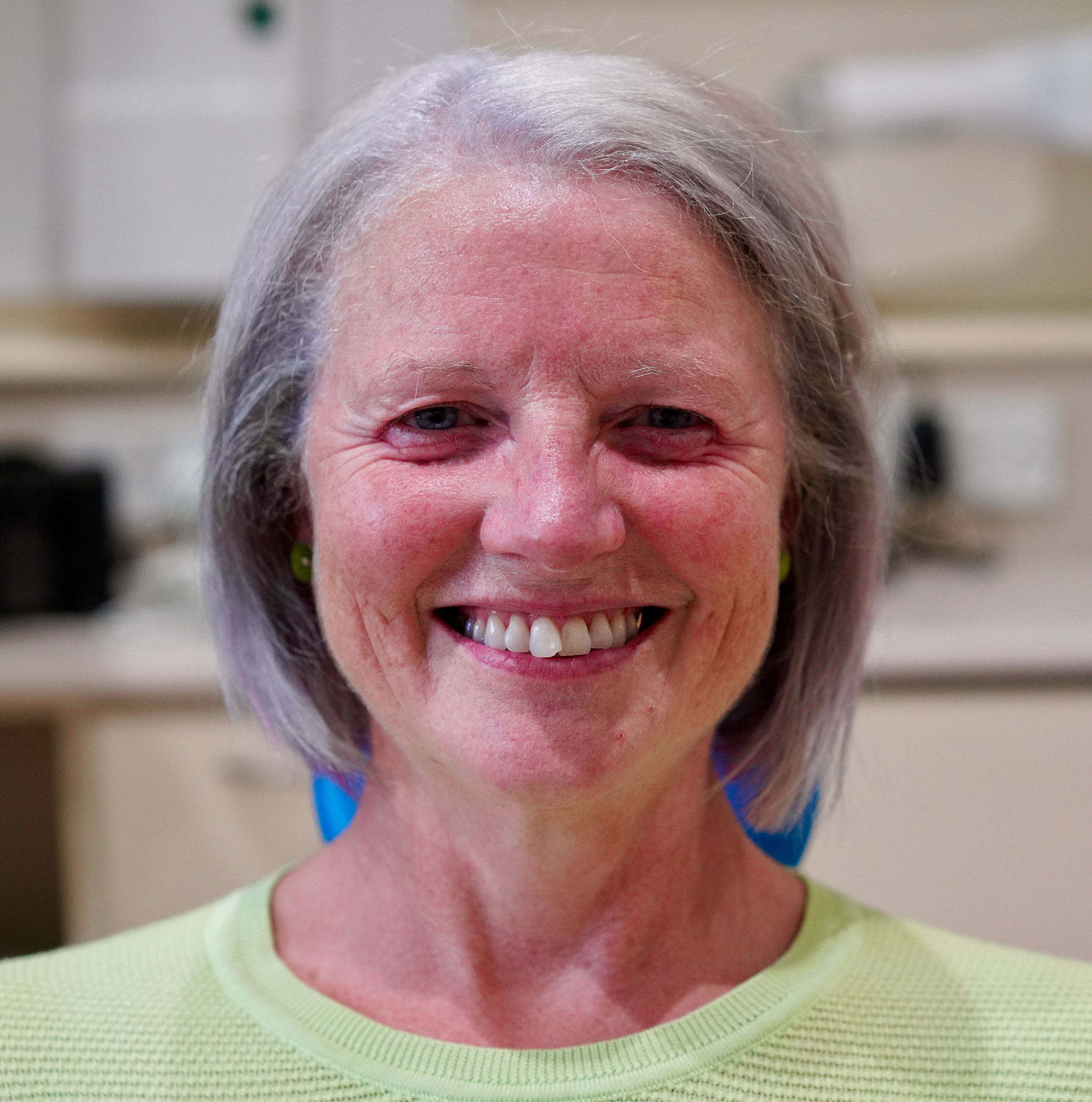 Invisalign - Before
