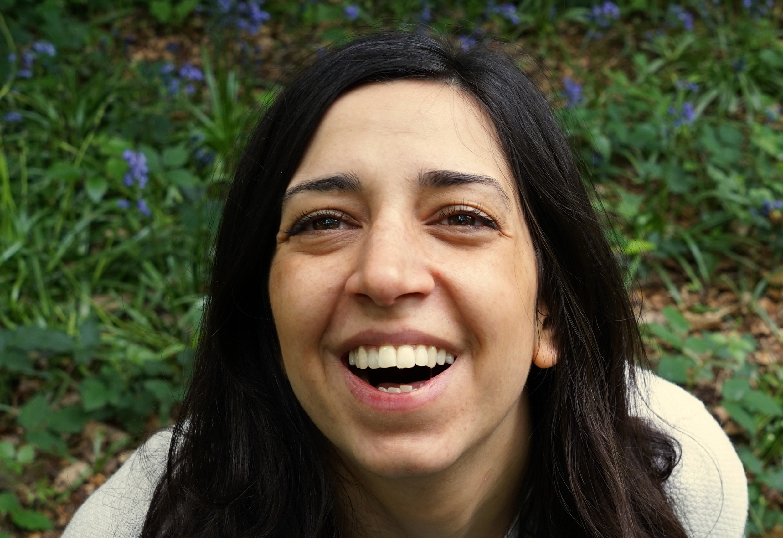 Invisalign - Before